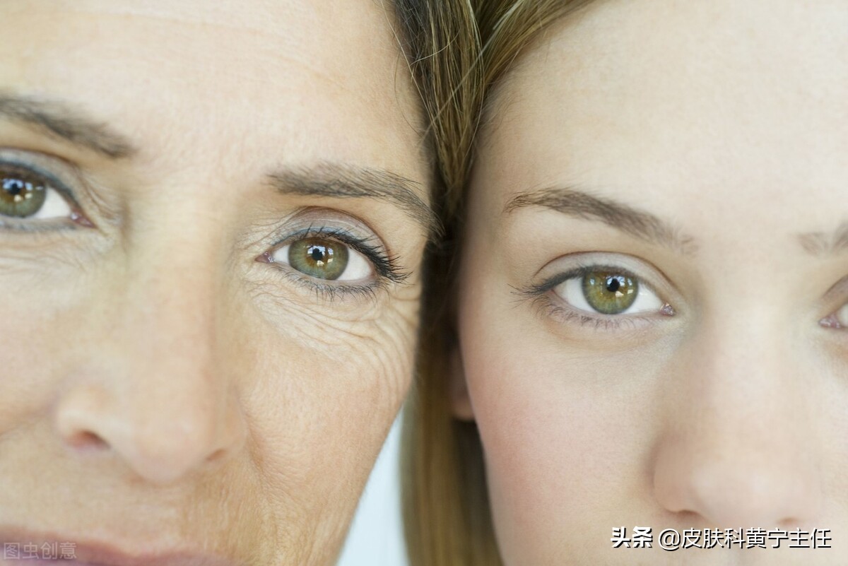 眼皮长脂肪粒像针眼一样怎么去除,眼睛周围的脂肪粒可以激光去除吗