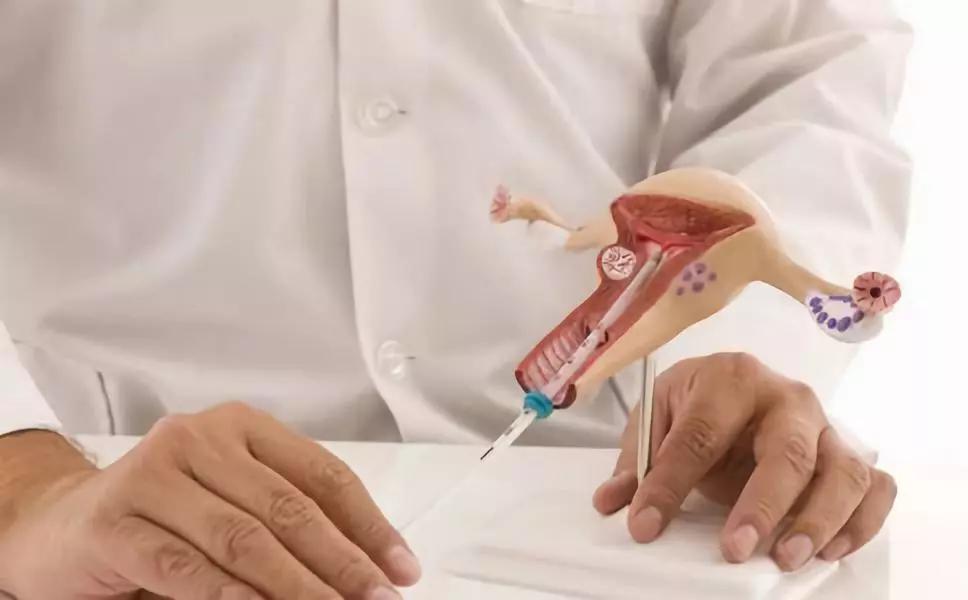 b超检测出的卵泡都能取出来吗,卵泡b超怎么能看出卵泡已排出