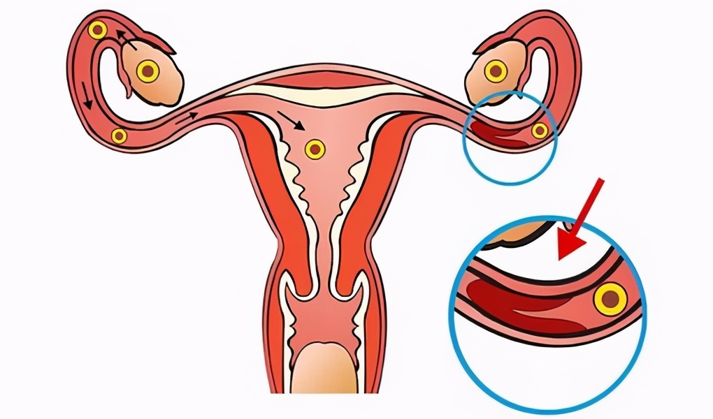 有妇科病的女人会影响男人么,有妇科病怀孕了对胎儿有影响吗