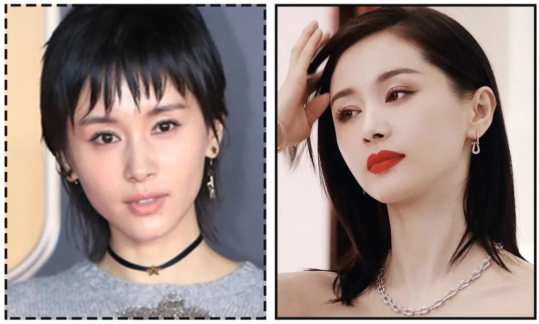 娄艺潇填充脂肪前后对比,娄艺潇填充前后对比