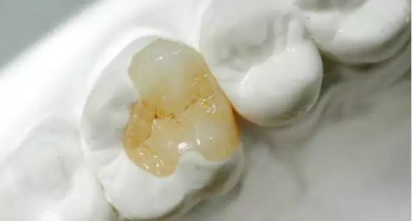 看牙收费太高了怎么要回来,看牙被多收费怎么办