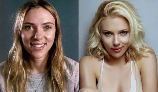 头油头屑多怎么去除小妙招,头油头屑怎么消除最快方法