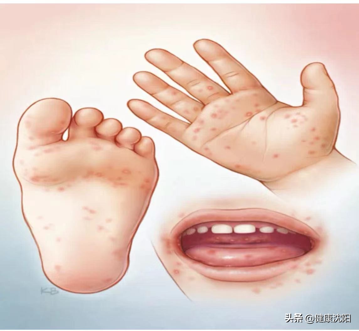 健康科普堂得了流感不要怕,健康科普堂皮肤常见的恶性肿瘤