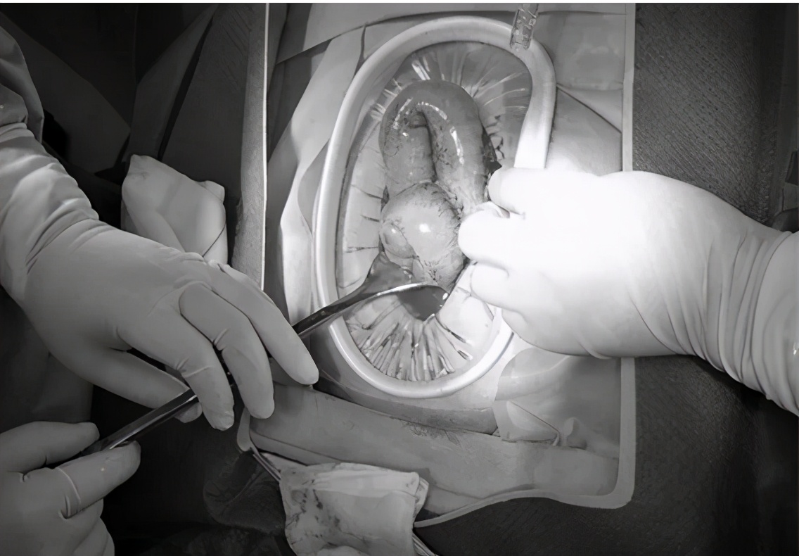 红果助消化吗,红果消食