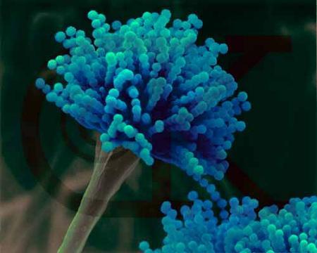 霉菌是什么病图片,霉菌是啥