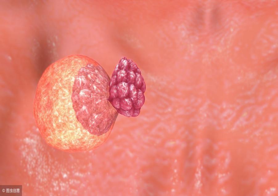 卵巢早衰月经量少用什么药,月经量少或提示卵巢早衰