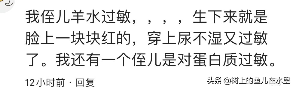 你身边有哪些特殊的体质？网友：我对自己的头发过敏