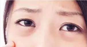 眼霜如何挑选先来看看这篇干货,眼霜推荐排行榜第一名怎么选