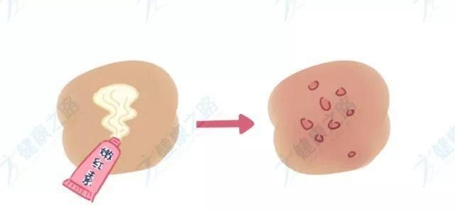如果大腿黑了用什么才能变白,大腿内侧颜色暗能自己变白吗