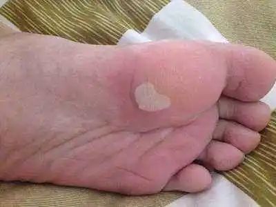 揭秘鞋厂防臭,鞋厂防霉方案