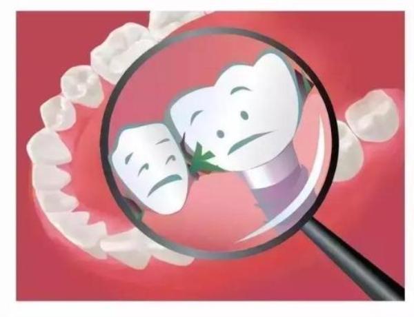 塞牙到底有多严重,塞牙问题能否解决