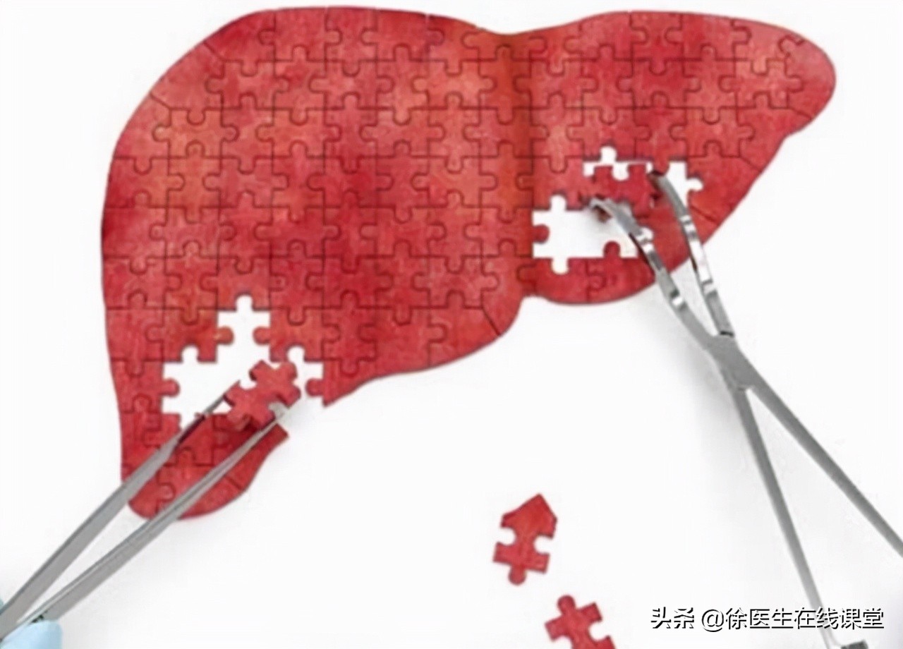 患上乙肝别害怕及时治疗是关键,发现乙肝该如何治疗最好