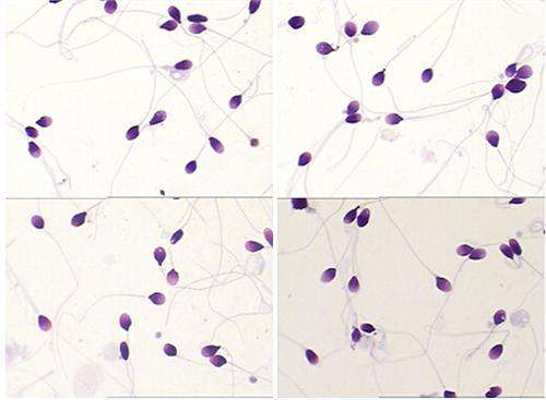 男性生育力评估要看哪些指标,男性生育力检测及评估