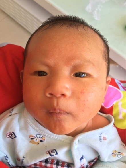 宝宝牙龈变形突出怎么恢复,宝宝上牙床凹凸不平怎么办