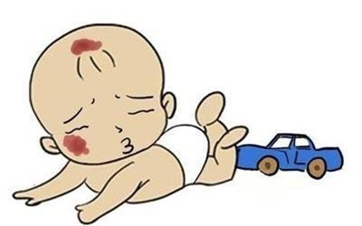 血管瘤的症状与危害70岁的老人,成人皮下血管瘤有什么症状和危害