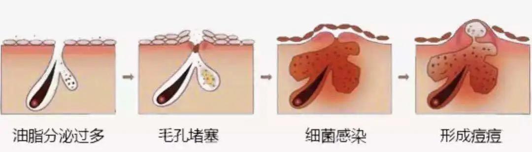 夏天做好6件事皮肤好到尖叫,这个夏天做好一件事