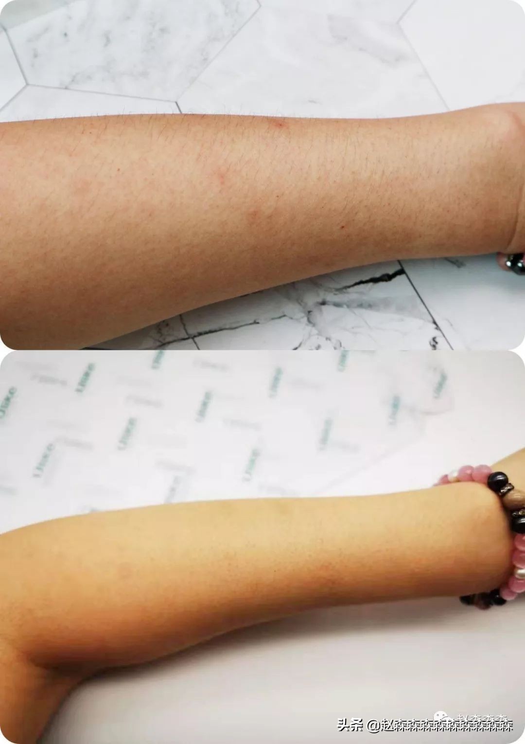 脱毛仪ulike和牛奶光美容仪的区别,beautigo奶冻脱毛仪和ulikeair3哪个好