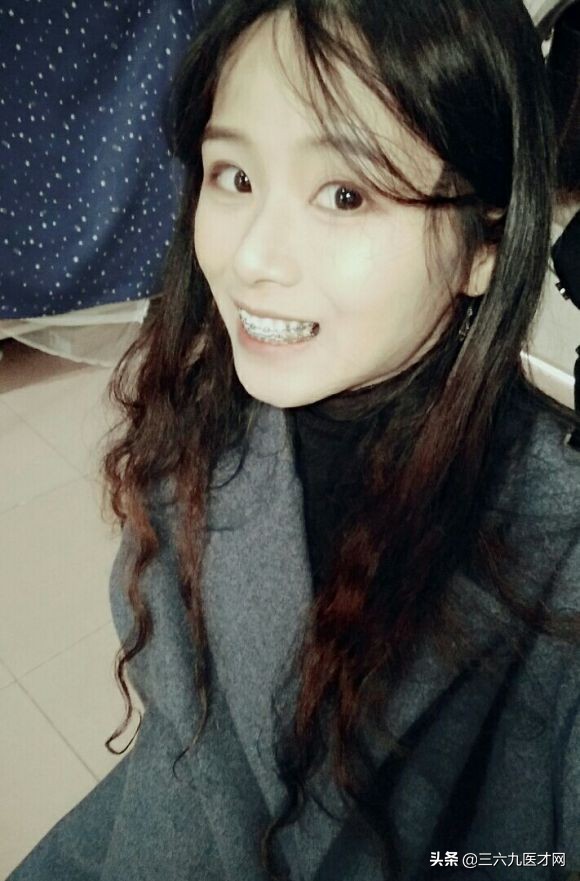 龅牙矫正成功的图片对比,2周岁龅牙可以矫正吗