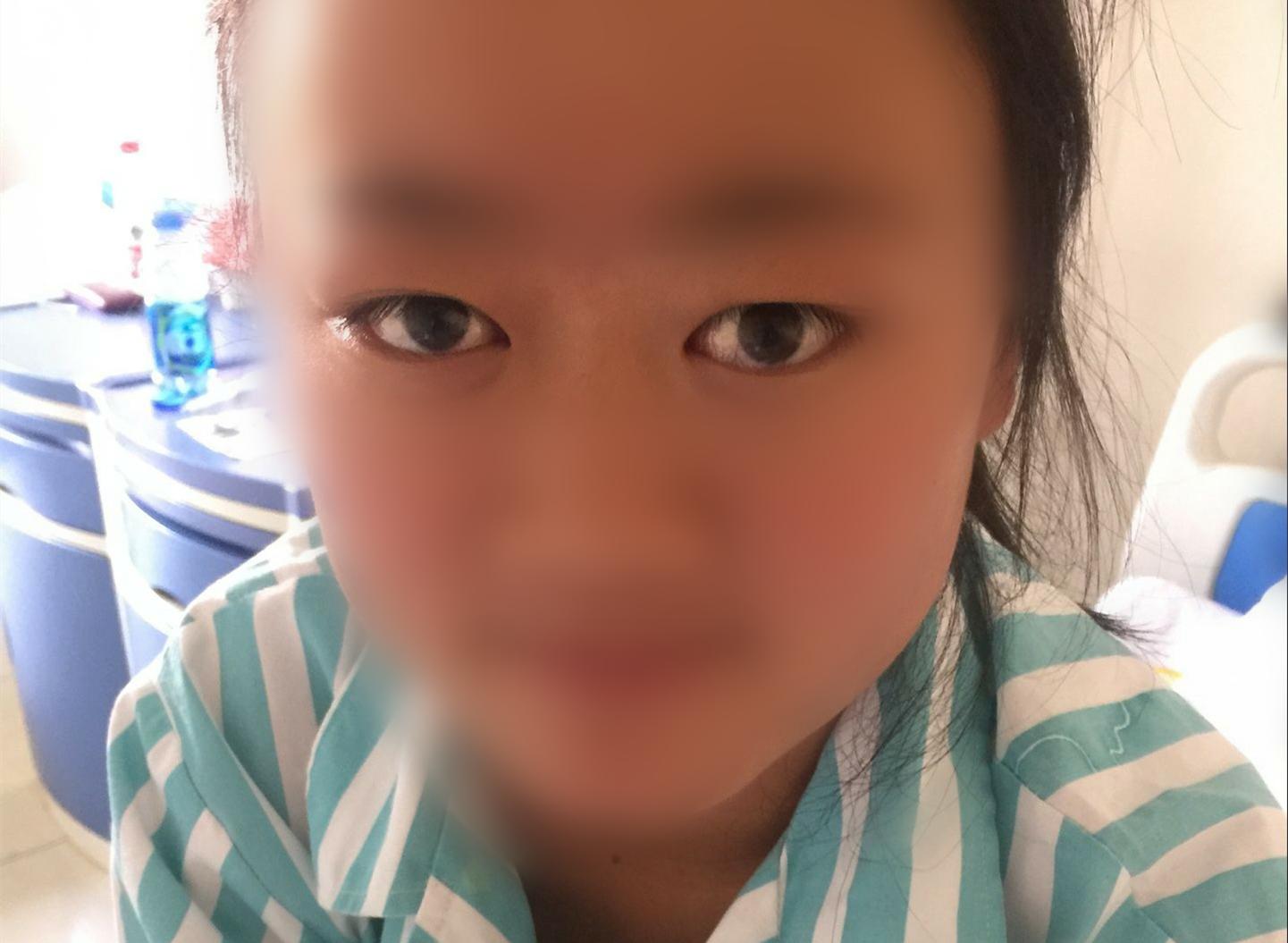 甲功八项全部异常,桥本氏病甲功五项哪项异常