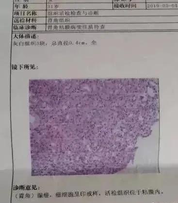 临床医生：3分钟看懂，胃镜活检病理报告！一定要收藏