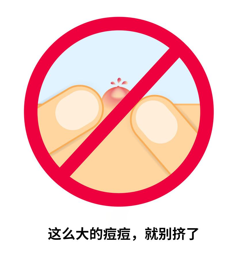 大学生挤痘痘引发的惨剧,女生挤痘痘导致面部感染