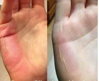 青草膏驱蚊止痒泰国正品,泰国进口青草膏居家旅游必备