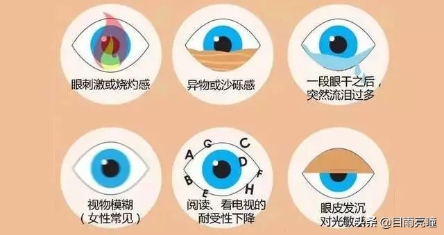 「实用」不想干眼症找上门？还不赶紧看过来