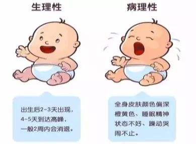 新生儿黄疸出院注意事项,初生婴儿黄疸偏高怎么护理