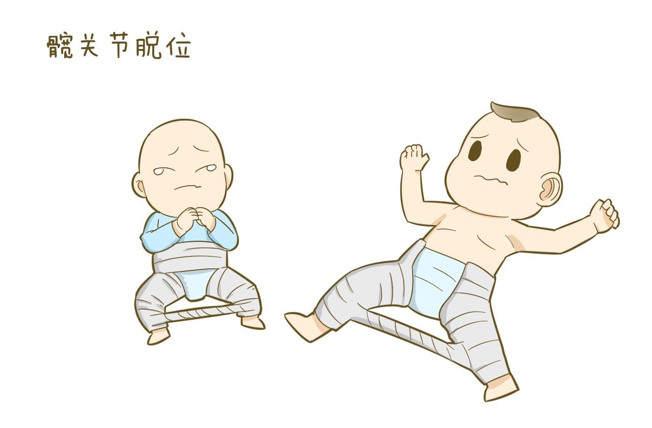 宝宝刚出生,婆婆就给宝宝绑手绑腿,害得被医生训斥