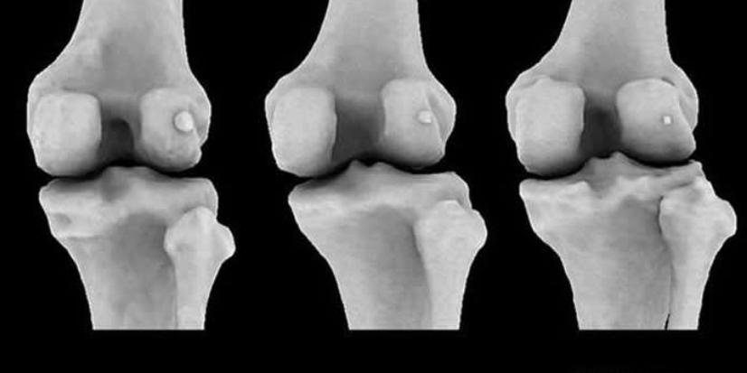 进化论能揭示人类奥秘,人类进化论的另一项有力证据