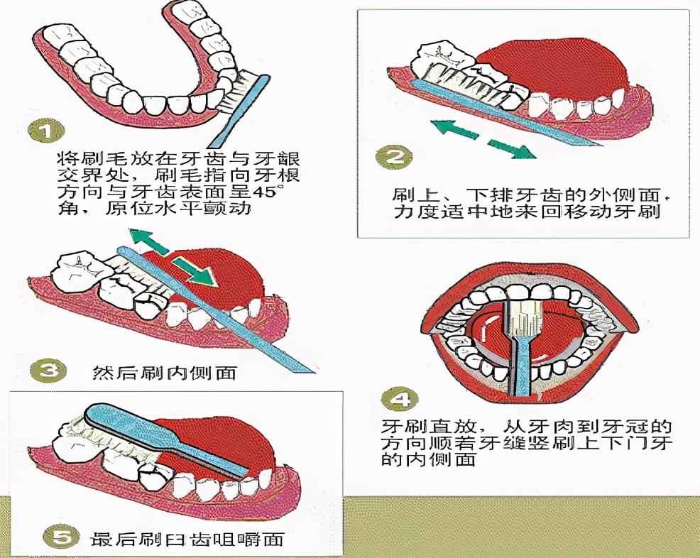 女孩牙龈罕见长出毛发,医生:之前都是男性