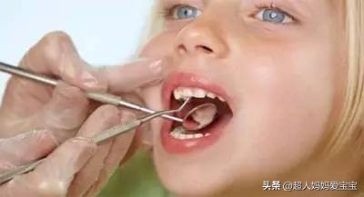 小孩的乳牙蛀牙了有必要补吗,孩子乳牙蛀牙有什么补救方法
