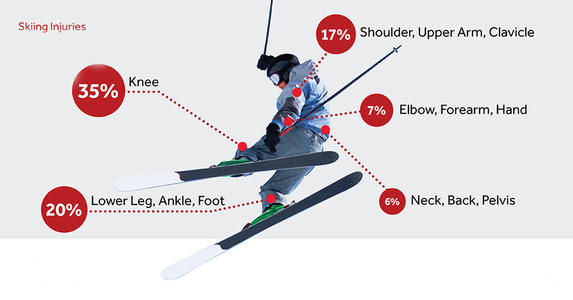 滑雪过程中手腕脚踝扭伤了怎么办,单板滑雪脚踝扭伤