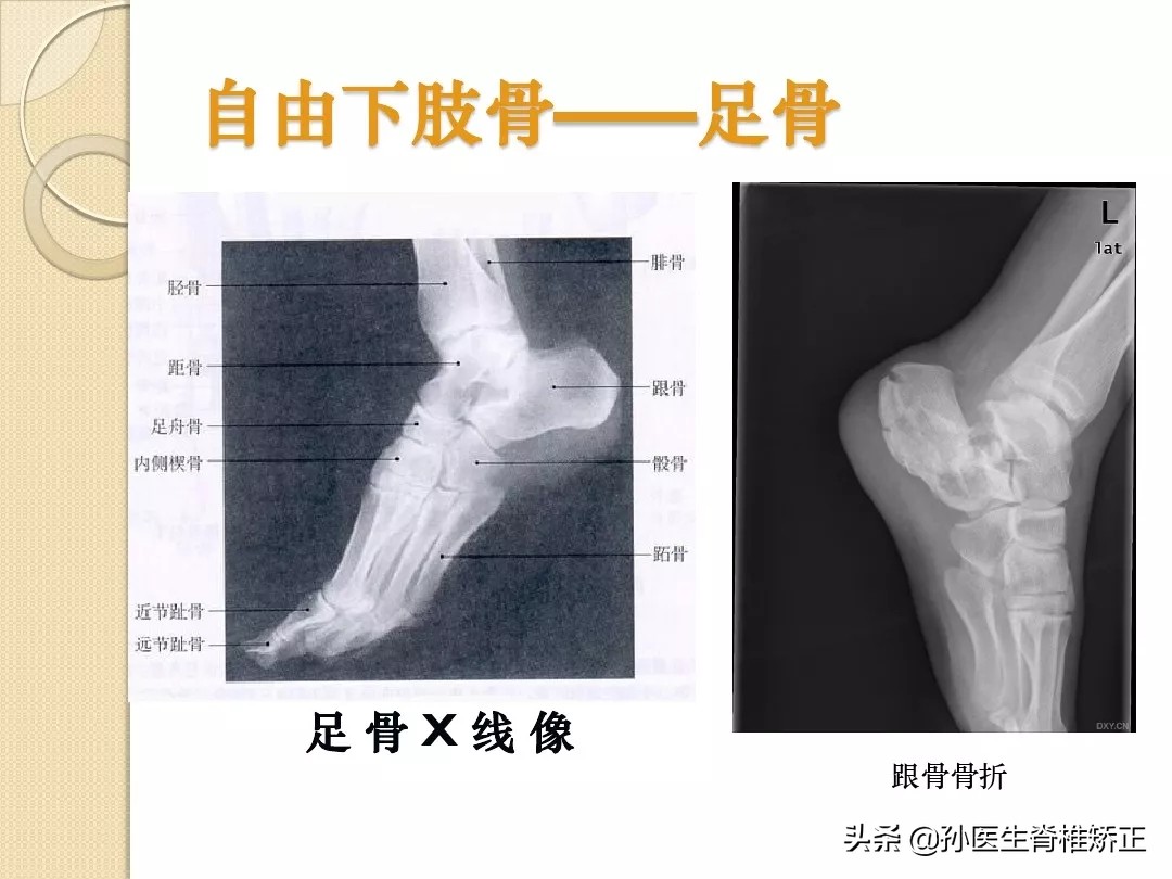 人体解剖学骨骼学思维导图,人体骨骼解剖学纪录片