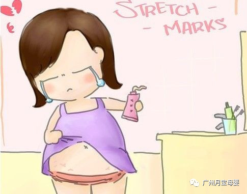 妊娠纹是无法避免吗,妊娠纹怎样才有救
