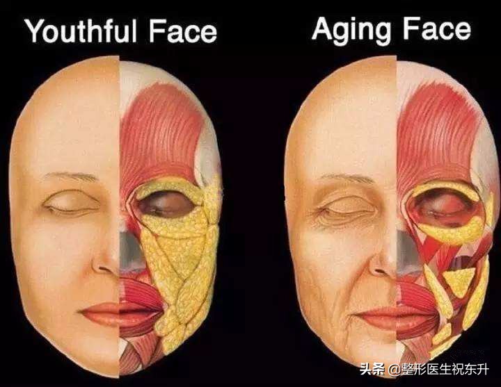 35岁面部松弛下垂做什么项目,35岁眼袋下垂松弛