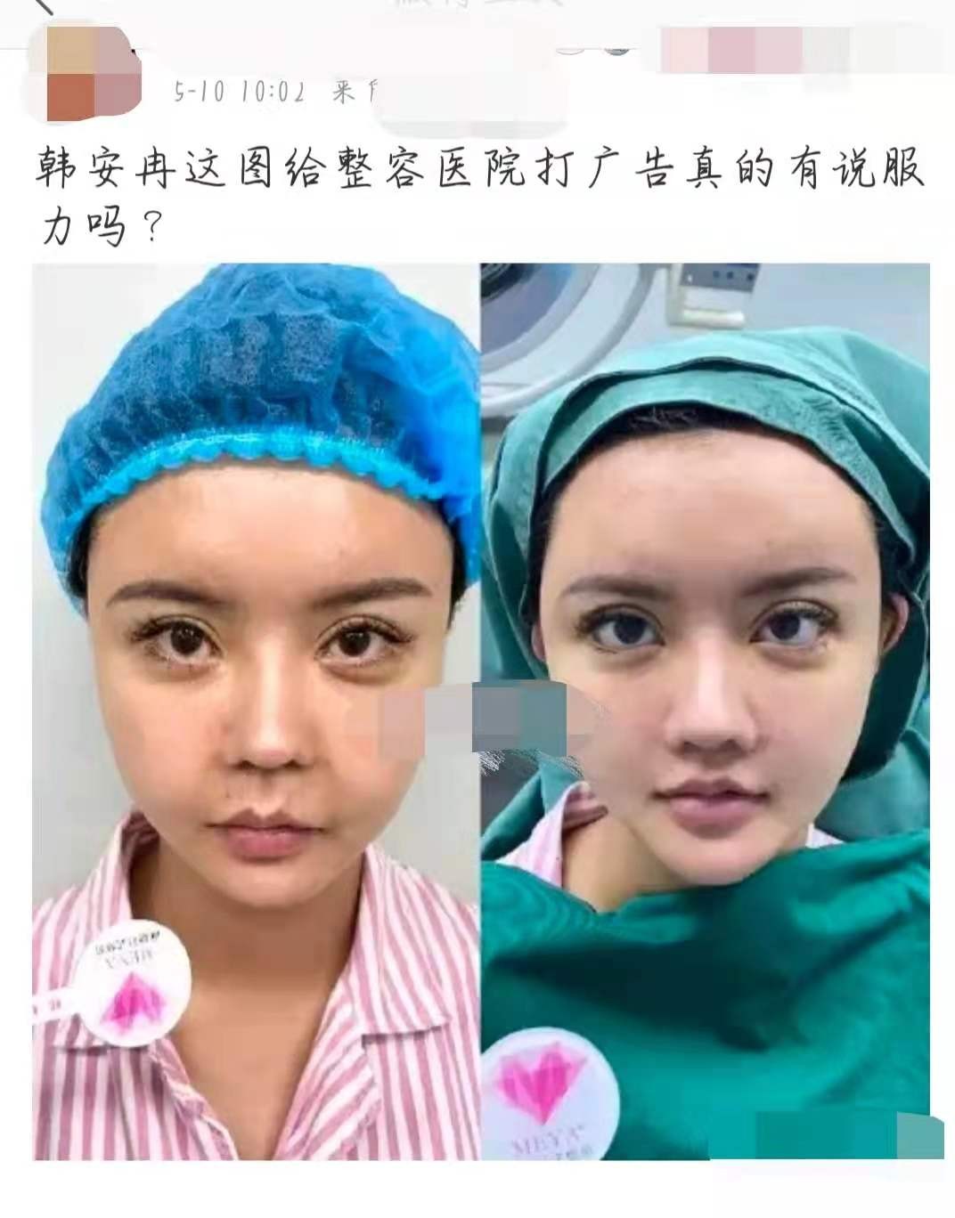 网红韩安冉整容了吗,网红失去滤镜后韩安冉整容明显