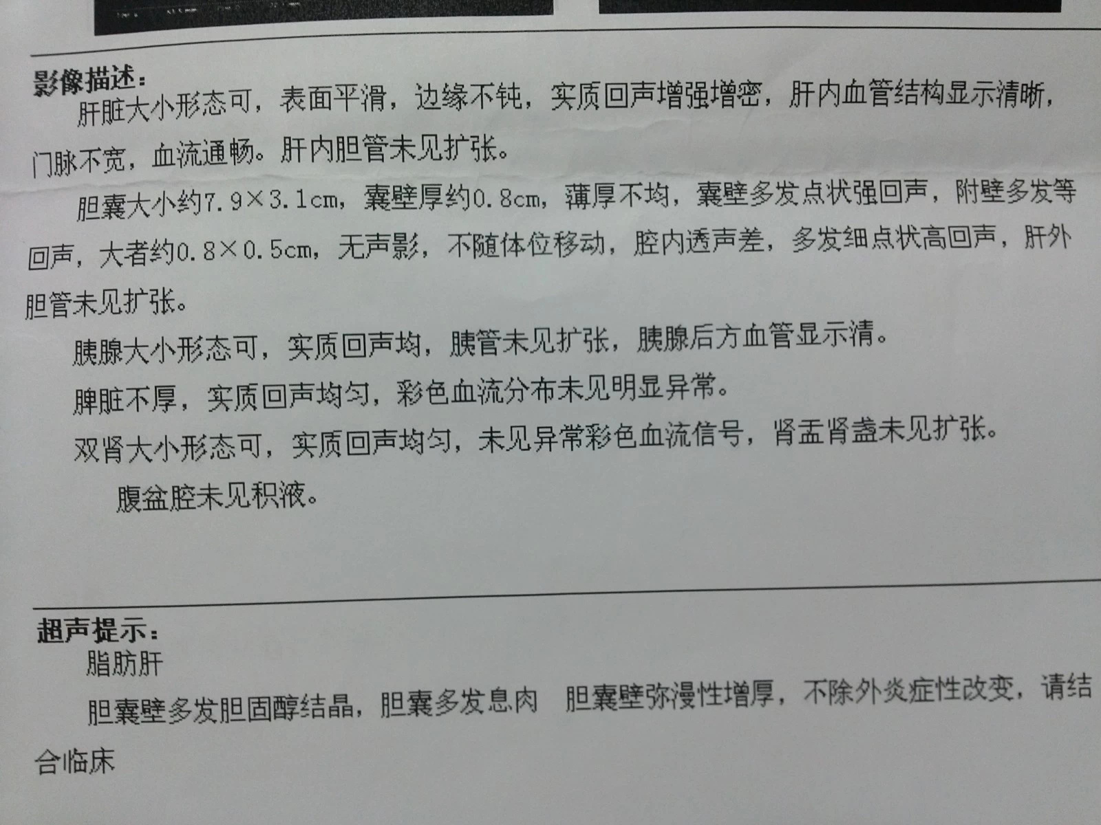跳广场舞能消除胆结石吗,对胆囊息肉有帮助的健身操