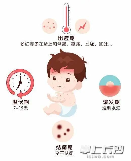 水痘频发,水痘高发期年龄段
