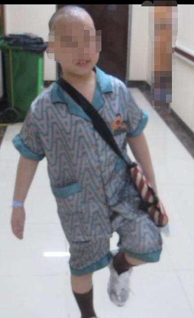 儿童脑出血昏迷三天后恢复正常了,脑出血后脑积水多久会出现症状