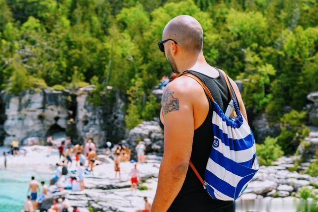 斑秃是怎么回事儿?除了用药,这几个方面别忘记