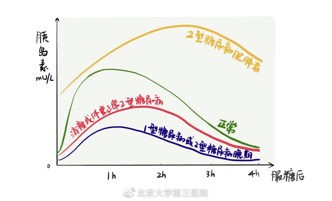 怎么看懂胰岛素和c肽化验单,如何读懂糖尿病化验单