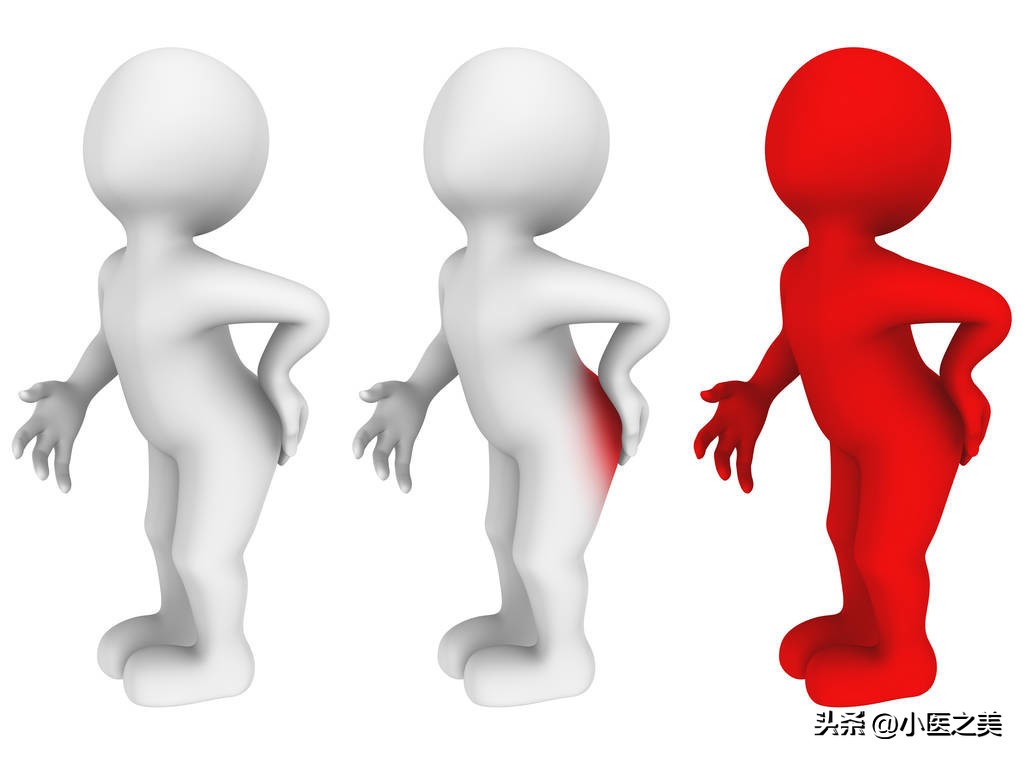 便便后还在滴鲜血,痔疮如何治疗、预防?