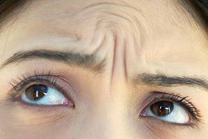 为什么抬头纹显得人这么老,多年的抬头纹怎么解决