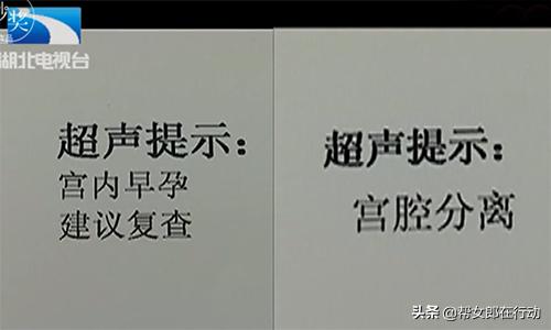 被怀孕？大姐人流手术进行中，却被告知：子宫里面什么都没有