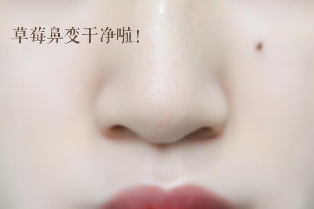 去黑头最好的套装,草莓鼻去黑头套装