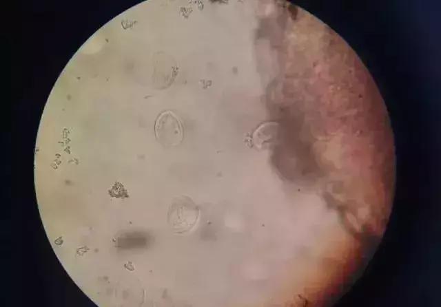 暴发“鱼瘟”救治时不可忽视寄生虫的危害---低温时节鱼类斜管虫病的症状及防治