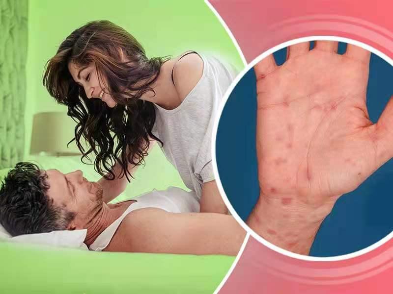 婚后查出梅毒婚姻有效吗,结婚后发现对方隐瞒患过梅毒