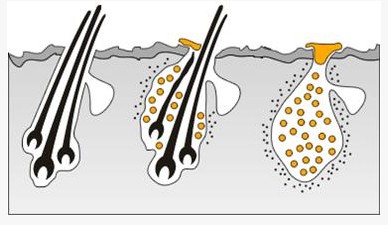 头发为什么越来越细软如何改善,为什么会有特别细软的头发