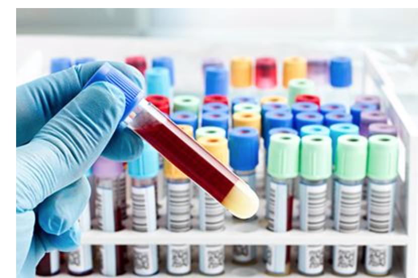 宝宝打了疫苗会白细胞低吗,儿童发热验血白细胞偏高